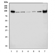 Western blot testing of 1) human U-87 MG, 2) human HEK293, 3) human HeLa, 4) rat brain, 5) rat lung, 6) mouse brain and 7) mouse lung tissue lysate with Mutated in Colorectal Cancers antibody. Predicted molecular weight ~91 kDa.