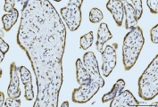 IHC staining of FFPE human placental tissue with MOV10 antibody. HIER: boil tissue sections in pH8 EDTA for 20 min and allow to cool before testing.