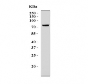 Western blot testing of human K562 cell lysate with Meiotic recombination 11 antibody. Predicted molecular weight ~81 kDa.