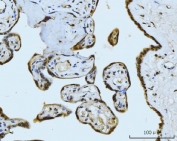 IHC staining of FFPE human placental tissue with Meiotic recombination 11 antibody. HIER: boil tissue sections in pH8 EDTA for 20 min and allow to cool before testing.