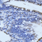 IHC staining of FFPE rat colon tissue with Meiotic recombination 11 antibody. HIER: boil tissue sections in pH8 EDTA for 20 min and allow to cool before testing.