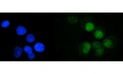 Immunofluorescent staining of FFPE human T-47D cells with Meiotic recombination 11 antibody (green) and DAPI nuclear stain (blue). HIER: steam section in pH6 citrate buffer for 20 min.