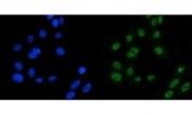 Immunofluorescent staining of FFPE human U-2 OS cells with MSH6 antibody (green) and DAPI nuclear stain (blue). HIER: steam section in pH6 citrate buffer for 20 min.