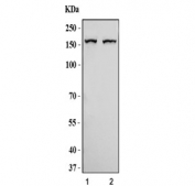 Western blot testing of human 1) HepG2 and 2) A549 cell lysate with MSH6 antibody. Expected molecular weight: 120-160 kDa depending on phosphorylation level.