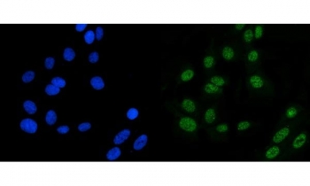 Immunofluorescent staining of FFPE human U-2 OS cells with MSH6 antibody (green) and DAPI nuclear stain (blue). HIER: steam section in pH6 citrate buffer for 20 min.