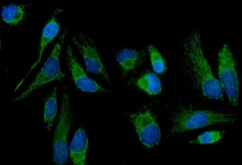 Immunofluorescent staining of FFPE human HeLa cells with MT-ND5 antibody (green) and DAPI nuclear stain (blue). HIER: steam section in pH6 citrate buffer for 20 min.