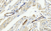 IHC staining of FFPE rat heart tissue with MT-ND5 antibody. HIER: boil tissue sections in pH8 EDTA for 20 min and allow to cool before testing.