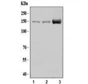 Western blot testing of 1) human HCCP, 2) rat liver and 3) mouse liver tissue lysate with NPC1L1 antibody. Predicted molecular weight ~149 kDa.