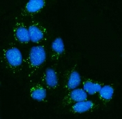 Immunofluorescent staining of FFPE human Hep3B cells with NPC1L1 antibody (green) and DAPI nuclear stain (blue). HIER: steam section in pH6 citrate buffer for 20 min.