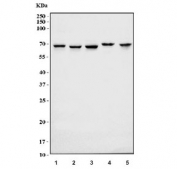 Western blot testing of 1) human HeLa, 2) human Caco-2, 3) human HepG2, 4) human HCCT and 5) rat pancreas tissue lysate with NUP58 antibody. Predicted molecular weight: 58-61 kDa.