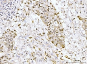 IHC staining of FFPE human liver tissue with NUP210 antibody. HIER: boil tissue sections in pH8 EDTA for 20 min and allow to cool before testing.