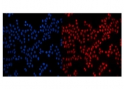 Immunofluorescent staining of FFPE human MCF7 cells with NUP210 antibody (red) and DAPI nuclear stain (blue). HIER: steam section in pH6 citrate buffer for 20 min.