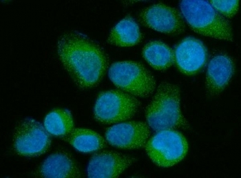 Immunofluorescent staining of FFPE human SiHa cells with OS9 antibody (green) and DAPI nuclear stain (blue). HIER: steam section in pH6 citrate buffer for 20 min.~