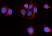 Immunofluorescent staining of FFPE human MCF7 cells with Myomegalin antibody (red) and DAPI nuclear stain (blue). HIER: steam section in pH6 citrate buffer for 20 min.