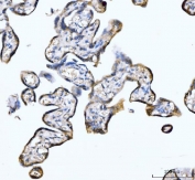 IHC staining of FFPE human placental tissue with Myomegalin antibody. HIER: boil tissue sections in pH8 EDTA for 20 min and allow to cool before testing.