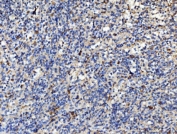 IHC staining of FFPE human spleen tissue with PLD3 antibody. HIER: boil tissue sections in pH8 EDTA for 20 min and allow to cool before testing.