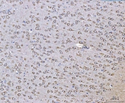 IHC staining of FFPE rat brain tissue with PLD3 antibody. HIER: boil tissue sections in pH8 EDTA for 20 min and allow to cool before testing.
