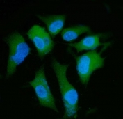 Immunofluorescent staining of FFPE human A549 cells with PPP2R1A antibody (green) and DAPI nuclear stain (blue). HIER: steam section in pH6 citrate buffer for 20 min.
