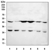 Western blot testing of 1) human HeLa, 2) human HaCaT, 3) human MCF7, 4) human A549, 5) rat brain and 6) mouse brain tissue lysate with Prostaglandin E synthase 2 antibody. Predicted molecular weight: ~42 kDa but can be visualized at 30-35 kDa.