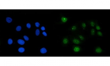 Immunofluorescent staining of FFPE human MCF7 cells with RAE1 antibody (green) and DAPI nuclear stain (blue). HIER: steam section in pH6 citrate buffer for 20 min.