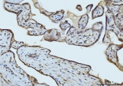 IHC staining of FFPE human placental tissue with RAE1 antibody. HIER: boil tissue sections in pH8 EDTA for 20 min and allow to cool before testing.