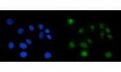 Immunofluorescent staining of FFPE human MCF7 cells with RAE1 antibody (green) and DAPI nuclear stain (blue). HIER: steam section in pH6 citrate buffer for 20 min.