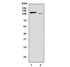 Western blot testing of human 1) K562 and 2) HL60 cell lysate with RBM28 a