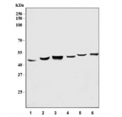 Western blot testing of 1) human SGC-7901, 2) human A549, 3) human HEK293, 4) rat liver, 5) mouse liver and 6) mouse HEPA1-6 cell lysate with RBM41 antibody. Predicted molecular weight ~47 kDa.