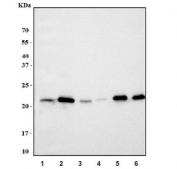 Western blot testing of 1) rat brain, 2) rat pancreas, 3) rat C6, 4) mouse brain, 5) mouse pancreas and 6) mouse RAW264.7 cell lysate with Rpl9 antibody. Predicted molecular weight ~22 kDa.