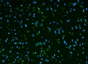 Immunofluorescent staining of FFPE mouse brain tissue with Rpl9 antibody (green) and DAPI nuclear stain (blue). HIER: steam section in pH6 citrate buffer for 20 min.