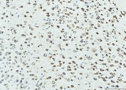 IHC staining of FFPE mouse brain tissue with RPL23 antibody. HIER: boil tissue sections in pH8 EDTA for 20 min and allow to cool before testing.