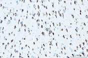 IHC staining of FFPE rat brain tissue with RPL23 antibody. HIER: boil tissue sections in pH8 EDTA for 20 min and allow to cool before testing.