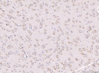 IHC staining of FFPE rat brain tissue with RPL29 antibody. HIER: boil tissue sections in pH8 EDTA for 20 min and allow to cool before testing.