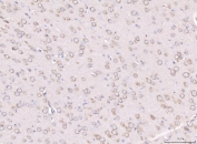 IHC staining of FFPE rat brain tissue with RPL29 antibody. HIER: boil tissue sections in pH8 EDTA for 20 min and allow to cool before testing.
