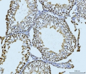 IHC staining of FFPE rat testis tissue with SBNO1 antibody. HIER: boil tissue sections in pH8 EDTA for 20 min and allow to cool before testing.