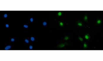 Immunofluorescent staining of FFPE human A549 cells with SBNO1 antibody (green) and DAPI nuclear stain (blue). HIER: steam section in pH6 citrate buffer for 20 min.