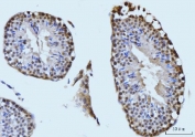 IHC staining of FFPE mouse testis tissue with SBNO1 antibody. HIER: boil tissue sections in pH8 EDTA for 20 min and allow to cool before testing.