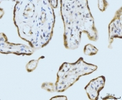 IHC staining of FFPE human placental tissue with SBNO1 antibody. HIER: boil tissue sections in pH8 EDTA for 20 min and allow to cool before testing.