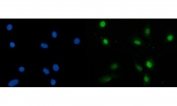 Immunofluorescent staining of FFPE human A549 cells with SBNO1 antibody (green) and DAPI nuclear stain (blue). HIER: steam section in pH6 citrate buffer for 20 min.