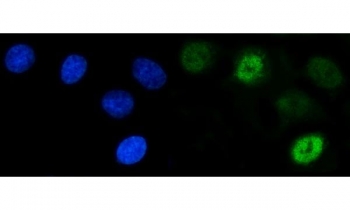 Immunofluorescent staining of FFPE human A549 cells with Synaptonemal Complex Protein 3 antibody (green) and DAPI nuclear stain (blue). HIER: steam section in pH6 citrate buffer for 20 min.