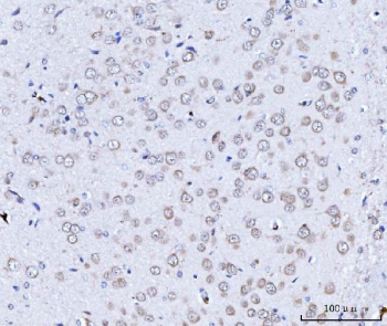 IHC staining of FFPE rat brain tissue with TARS2 antibody. HIER: boil tissue sections in pH8 EDTA for 20 min and allow to cool before testing.