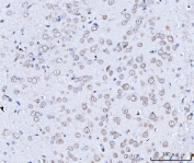 IHC staining of FFPE rat brain tissue with TARS2 antibody. HIER: boil tissue sections in pH8 EDTA for 20 min and allow to cool before testing.