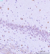 IHC staining of FFPE rat brain tissue with TARS2 antibody. HIER: boil tissue sections in pH8 EDTA for 20 min and allow to cool before testing.