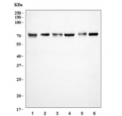 Western blot testing of 1) human HepG2, 2) human HeLa, 3) human ThP-1, 4) human Raji, 5) rat liver and 6) mouse liver tissue lysate with TARS2 antibody. Predicted molecular weight ~81 kDa (isoform 1) and ~66 kDa (isoform 2).
