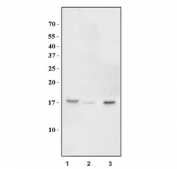 Western blot testing of human 1) HEK293, 2) HeLa and 3) Raji cell lysate with TBCA antibody. Expected molecular weight: 13-16 kDa.