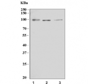 Western blot testing of 1) rat brain, 2) rat C6 and 3) mouse brain tissue lysate with Tlr6 antibody. Expected molecular weight: 91-100 kDa.