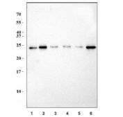 Western blot testing of 1) monkey COS-7, 2) human HEK293, 3) rat brain, 4) rat testis, 5) mouse brain and 6) mouse testis tissue lysate with Huntingtin interacting protein 2 antibody. Predicted molecular weight ~22 kDa.