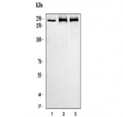 Western blot testing of human 1) MCF7, 2) Raji and 3) ThP-1 cell lysate with hUPF2 antibody. Predicted molecular weight ~148 kDa.