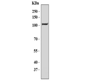 Western blot testing of human K562 cell lysate with ZC3H7A antibody. Predicted molecular weight ~111 kDa.