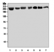 Western blot testing of 1) human A549, 2) human Caco-2, 3) human U-2 OS, 4) human HepG2, 5) rat liver, 6) mouse lung and 7) mouse ANA-1 cell lysate with FLNB antibody. Predicted molecular weight ~278 kDa.